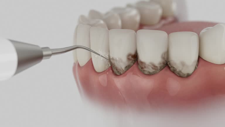 Reliable Dental Implants contractor in Matawan, NJ by Smile Center Dentistry
